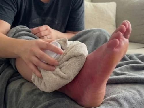 Bruciore e stanchezza